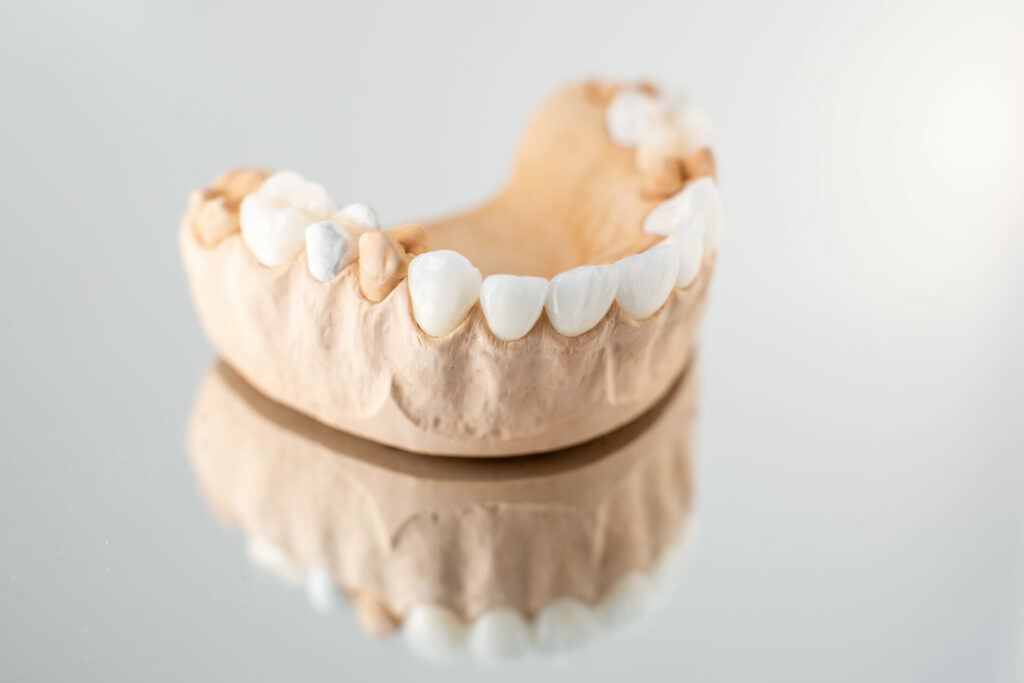 partial denture